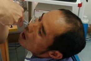 Доктор достал из носа пациента странное существо