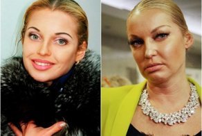 Старость не радость или 20 звёзд растерявших весь свой шарм и красоту с возрастом