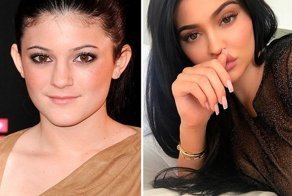 Самые дорогие пластические операции знаменитостей