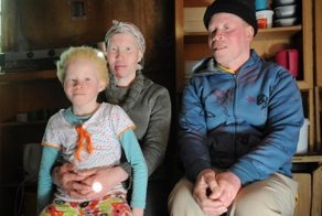 Африканские альбиносы не скрывают своих страхов