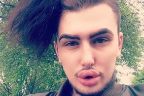 Парни, прекратите накачивать губы