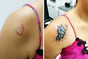 20 примеров того, как татуировка всё исправила