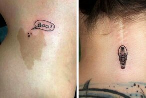 Если шрам скрыть не выходит, то его можно превратить в картину