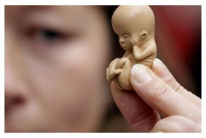 Депутат Госдумы Виталий Милонов предложил приравнять аборт к убийству