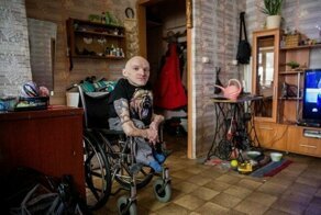 Человек из стекла: мальчик с очень редкой болезнью вырос и стал мастером на все руки