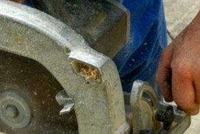 Женщина отпилила себе руку ради страховой выплаты