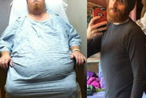 Из гадких утят: 18 преображений людей, которые взяли себя в руки и победили "широкую кость"