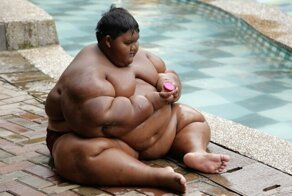 Самый толстый ребенок в мире похудел более чем на 100 килограмм