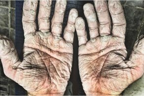 Цена победы: 20 фото конечностей спортсменов,  которые шокируют вас