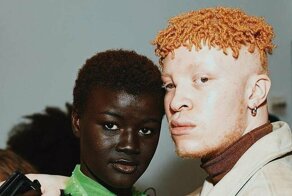 20 прекрасных генетических мутаций у людей