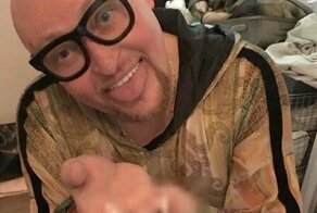 Певец Шура решил распродать свои зубы