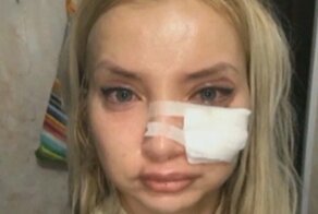 Горе-косметолог изуродовала почти два десятка человек и села в тюрьму