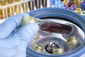 В России выявили регионы с необъявленной эпидемией ВИЧ