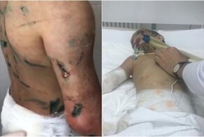 Били. Издевались. Тушили окурки