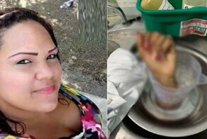 Ревнивый мужчина отрезал руку своей жене