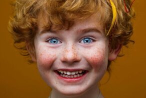 Почему летом появляются веснушки?