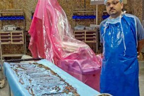 Из желудка индианки достали полтора килограмма украшений