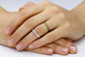 Почему темнеет кожа от золота?