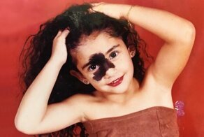 Бразильянку дразнили из-за родимого пятна, но теперь она модель и рушит стандарты красоты