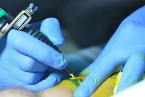 Разработаны биосенсорные татуировки для мониторинга хронических заболеваний