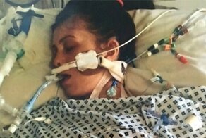 После укуса комара у девушки остановилось сердце