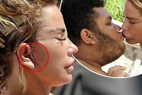 Не для слабонервных: фотомодель Кэти Прайс после очередной пластики