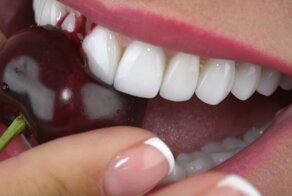 10 продуктов, которые вредят зубной эмали