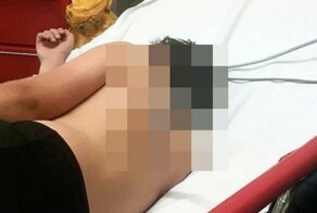 В Британии 12-летний мальчик получил весьма необычную травму, прыгая на батуте