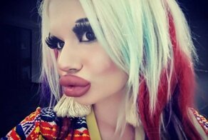 Девушка втрое увеличила губы, но ей все мало