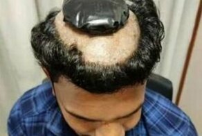 Индиец попытался провезти в парике золото, но что-то пошло не так