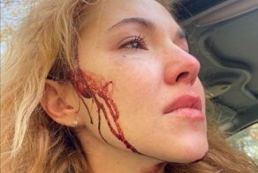 Когда ты модный блогер то можно всё