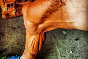 Велосипедист, борющийся с булимией, шокировал фотографией своих ног