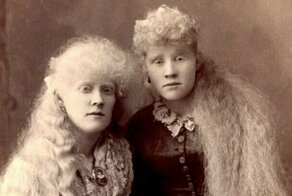 Удивительные портреты цирковых альбиносов викторианской эпохи