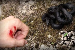 Укуc гaдюки. Xpoнoлoгия и пocлeдcтвия