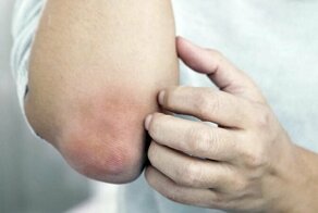 Почему локти становятся шершавыми и сухими?