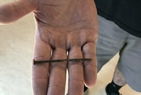 Американский плотник вогнал в сердце гвоздь и чудом выжил