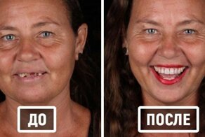 Стоматолог лечит зубы, и фотографии его работ показывают, как людей меняет улыбка