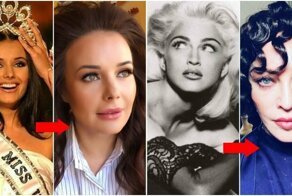 Было-стало. Знаменитости, загубившие свою внешность буйным омоложением (19 фото+видео)