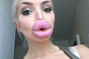 Бабьи накачанные губы и мужские мысли на эту тему