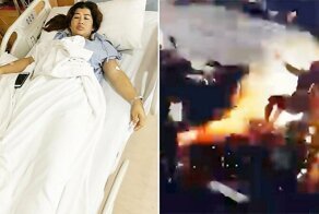 Женщина чудом осталась жива после удара током в 22000 вольт