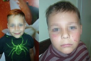 «Ах ты, свинья! Я тебя сейчас подпалю!»: четверо мальчишек жестоко избили третьеклассника
