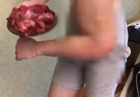 Кирилл «Руки-базуки» показал свою гордость после операции