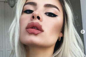 "Губы дьявола": новый тренд, на который трудно смотреть без слез