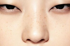 Почему у китайцев, корейцев и японцев узкие глаза?