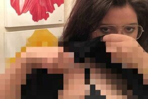 Британке удалили две лишние груди, и теперь она выглядит как другие женщины