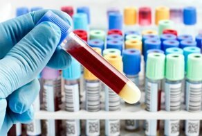 Ученые выяснили, с какой группой крови выше вероятность заразиться коронавирусом