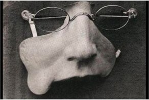 20 шокирующих фото о первых пластических операциях из прошлого