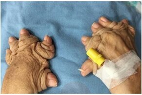 20 чудовищных человеческих аномалий: люди, которым плохо и без карантина