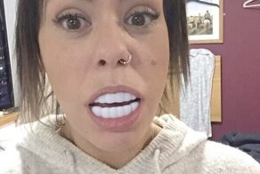 "Голливудская улыбка" с Амазона довела покупательницу до истерики