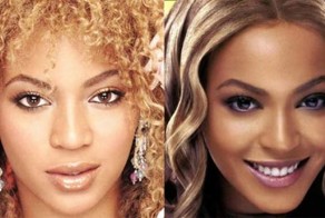 Как ринопластика изменила звезд (36 фото)